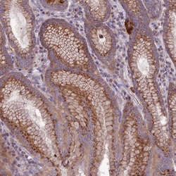 SPRYD7 Antibody, Novus Biologicals:Antibodies:Primary Antibodies